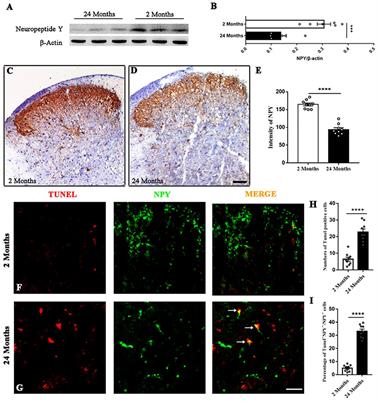 Lack of Spinal Neuropeptide Y Is Involved in Mechanical Itch in Aged Mice